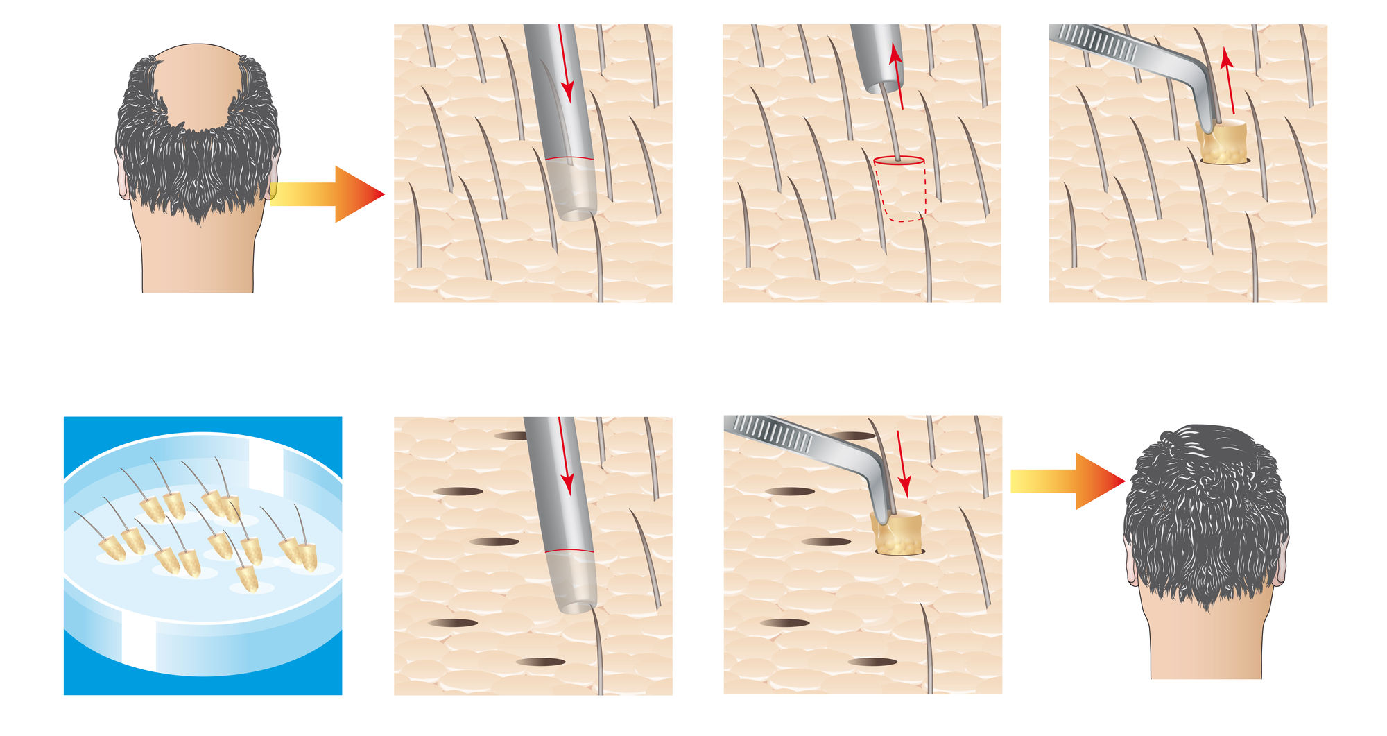 PRP before and after – See the results for yourself 3